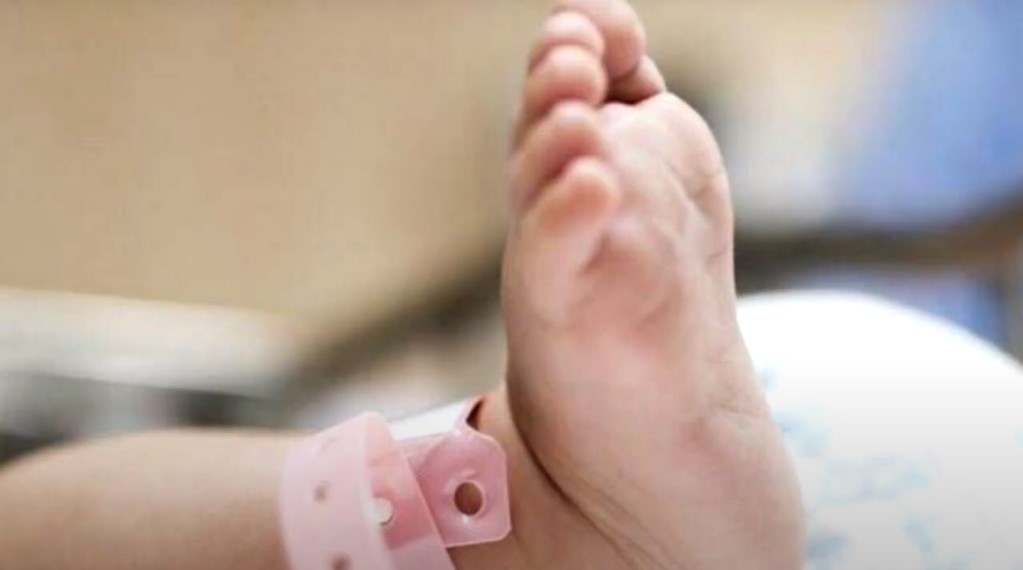 thumb