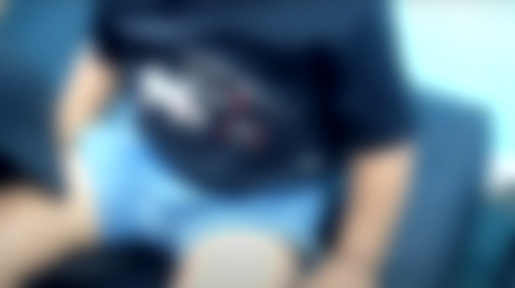 thumb